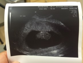 First Ultrasound
